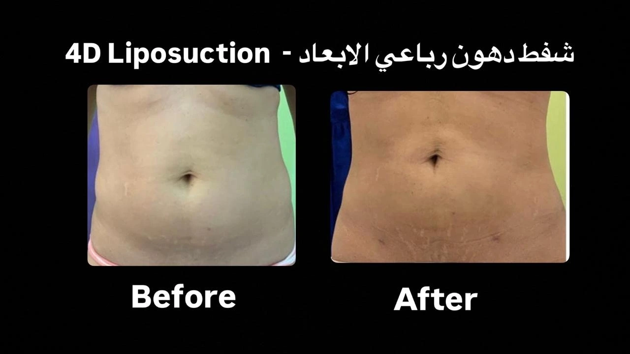 Patient review for plastic surgery procedure