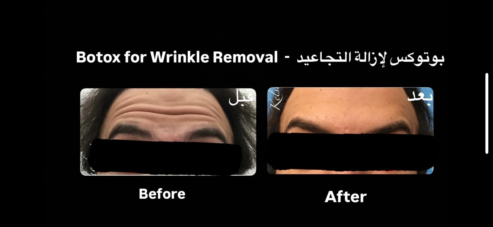 Patient review for plastic surgery procedure