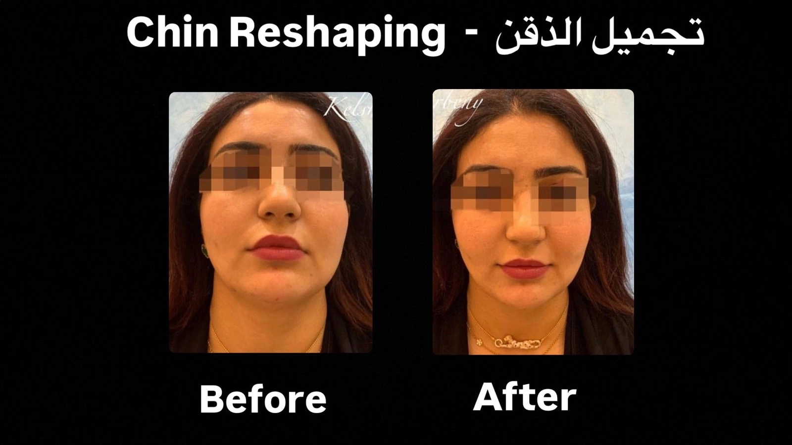 Advanced equipment in Dr. Khaled’s clinic