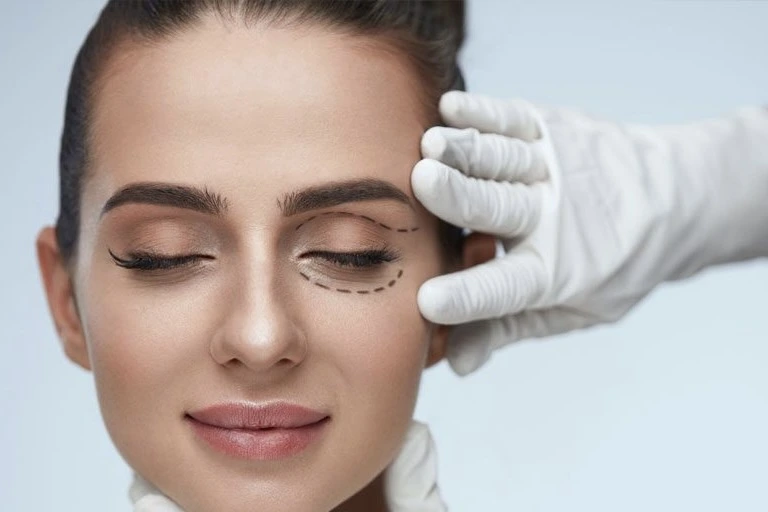 Blepharoplasty Eyelid Surgery Cairo Egypt - Dr. Khaled Elsherbiny