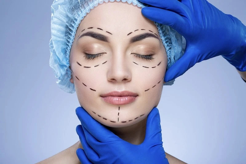 Facelift Surgery Cairo Egypt - Dr. Khaled Elsherbiny Facial Rejuvenation