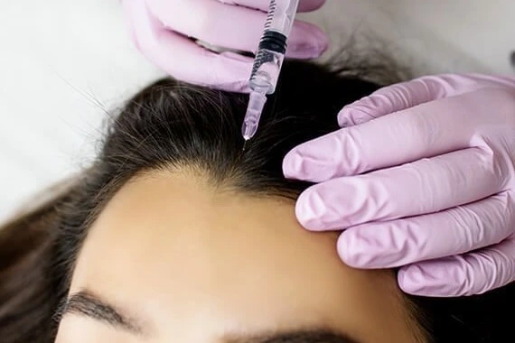 Mesotherapy Hair and Face Treatment Cairo Egypt - Dr. Khaled Elsherbiny