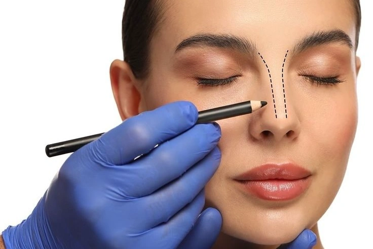 Rhinoplasty Nose Job Egypt Cairo - Dr. Khaled Elsherbiny Best Plastic Surgeon